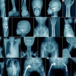 Emergenza – Radiologia