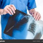 Radiazioni ionizzanti. Aifm: “Ancora scarsa la conoscenza tra la classe medica”