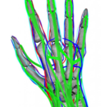 Paziente virtuale dalla Duke University in arrivo!