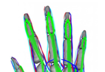 Paziente virtuale dalla Duke University in arrivo!